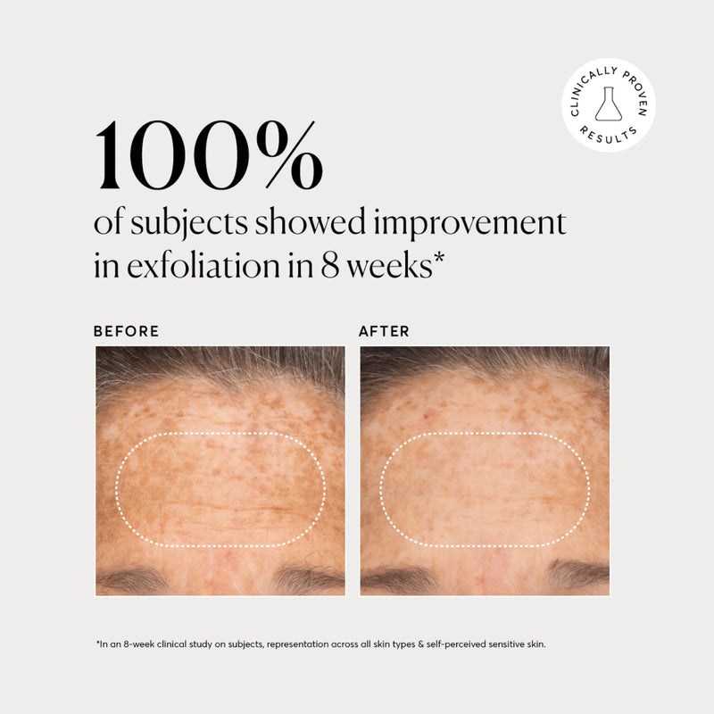 NATR-10027-Alt-Images-BHA-Liquid-Exfoliant-2_-03.jpg